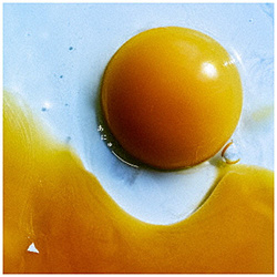 RADWIMPS/ あにゅー