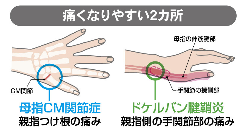 お医者さんの手首サポーター右手用 M ブラック 434764｜の通販はソフマップ[sofmap]