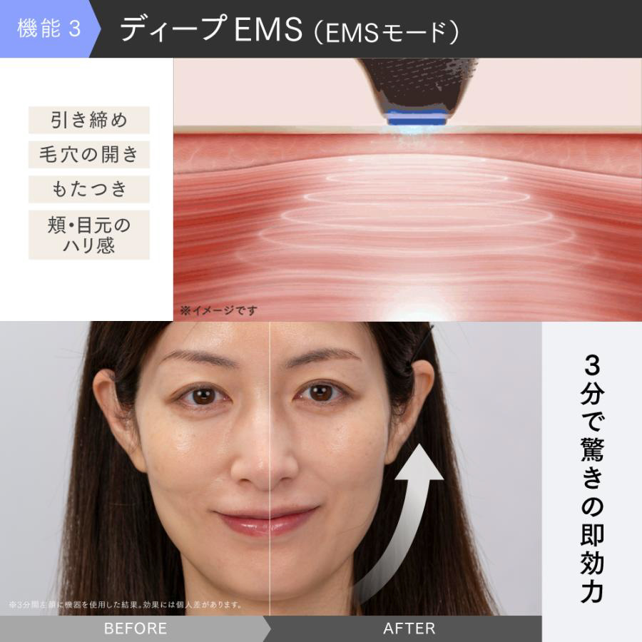 MiRAY ONE 美顔器 MT-MRO-24W MYTREX マルチヘッド美顔器 MiRAY ONE ホワイト MT-MRO-24W